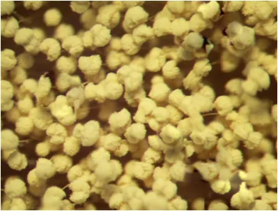 Aspergillus terreus under the microscope