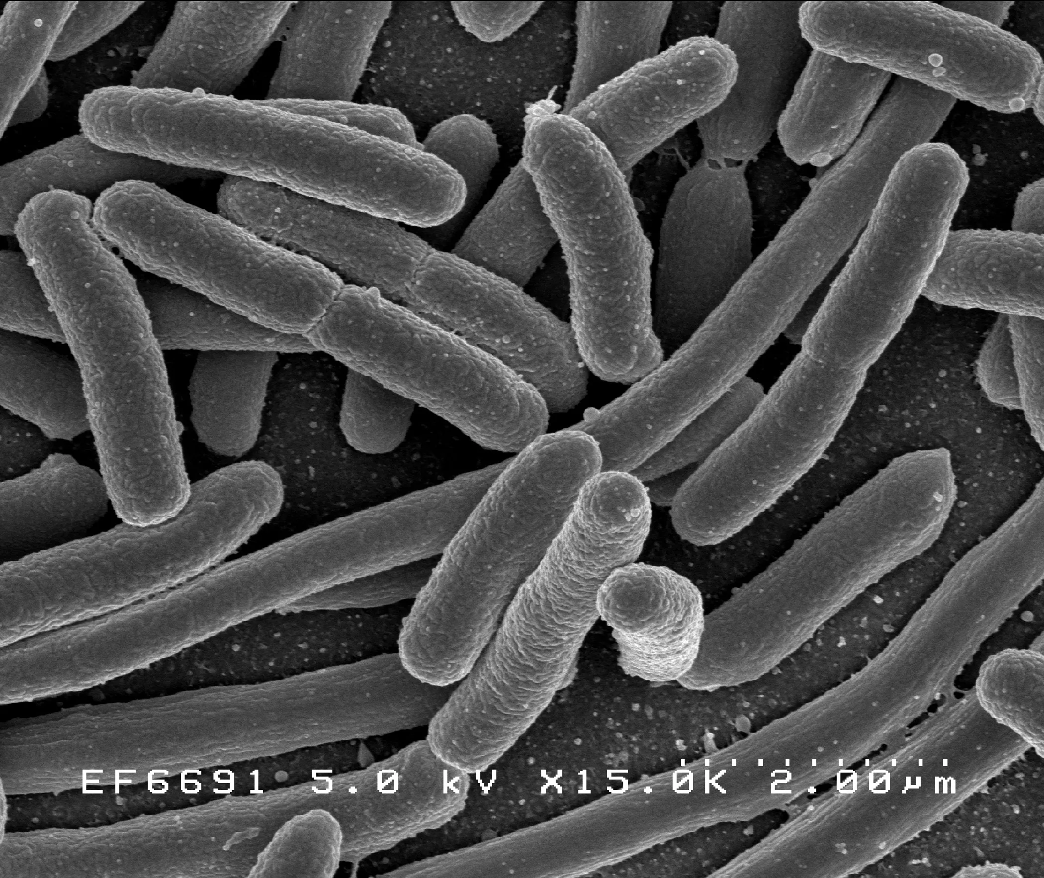Gram-negative bacterial material under the microscope