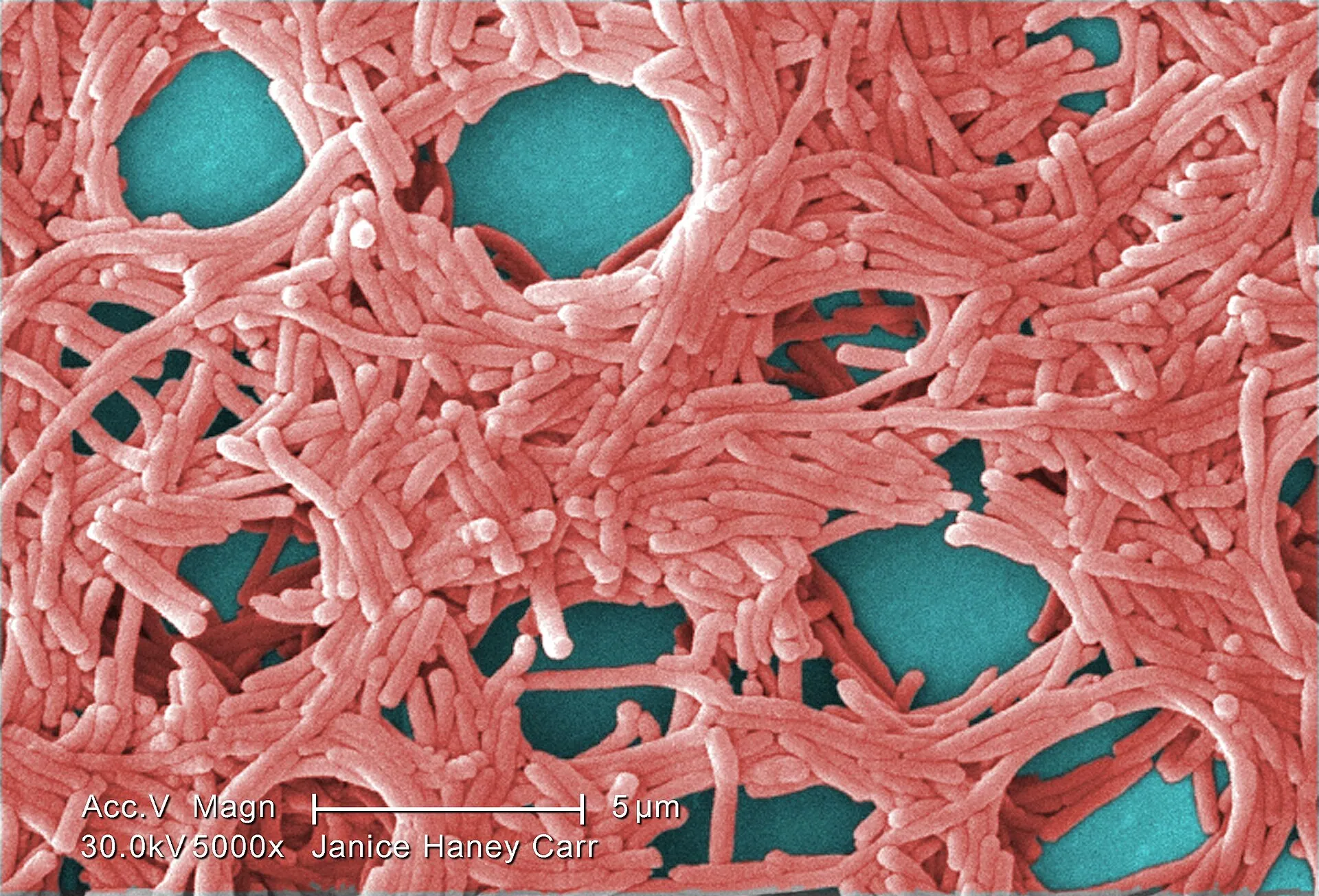 Legionella under the microscope